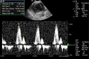 Cardiologie, clinique vétérinaire Avignon